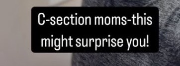 C-Section Recovery Guide: Healing, Scar Care, and Support